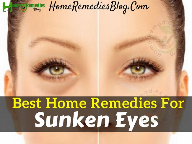 10 best home remedies to get rid of sunken eyes 10 best home remedies to get rid of sunken eyes