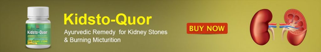 23 Easy Home Remedies for Kidney Stones 23 Easy Home Remedies for Kidney Stones