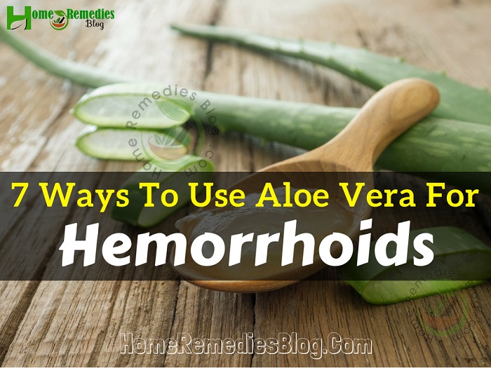 7 Möglichkeiten zur Anwendung von Aloe Vera bei Hämorrhoiden 7 Möglichkeiten zur Anwendung von Aloe Vera bei Hämorrhoiden