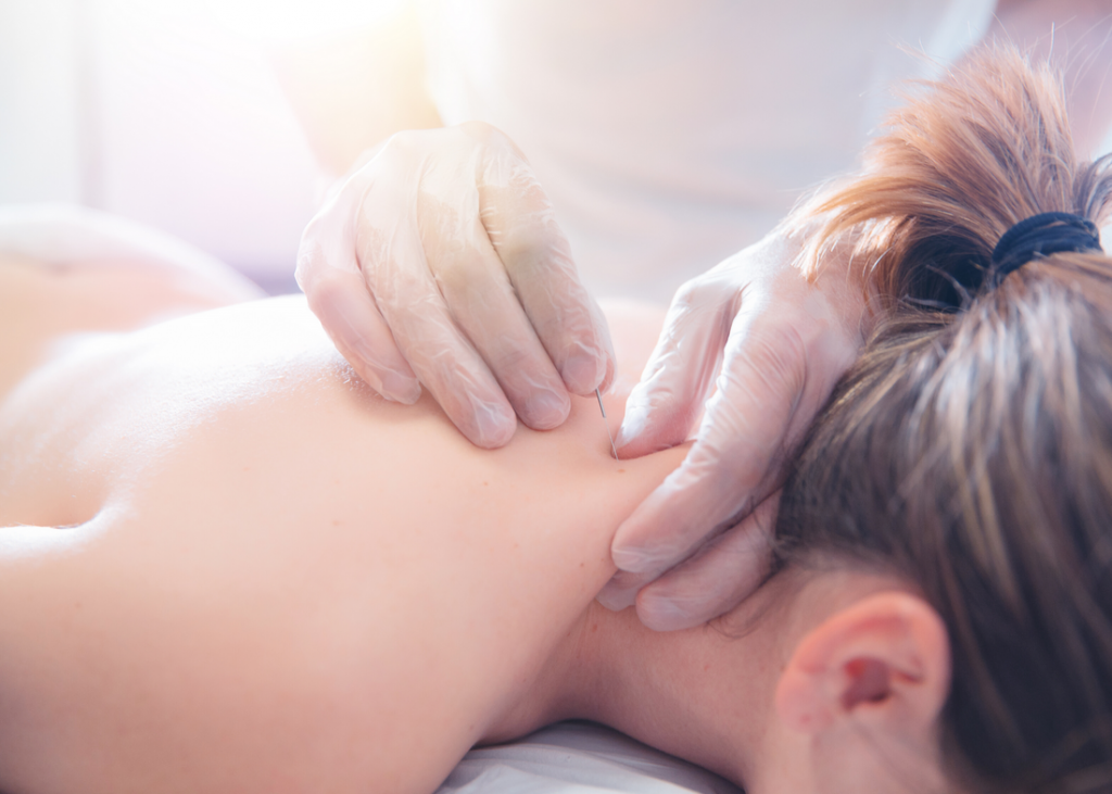 Dry needling – why it works Dry needling – why it works