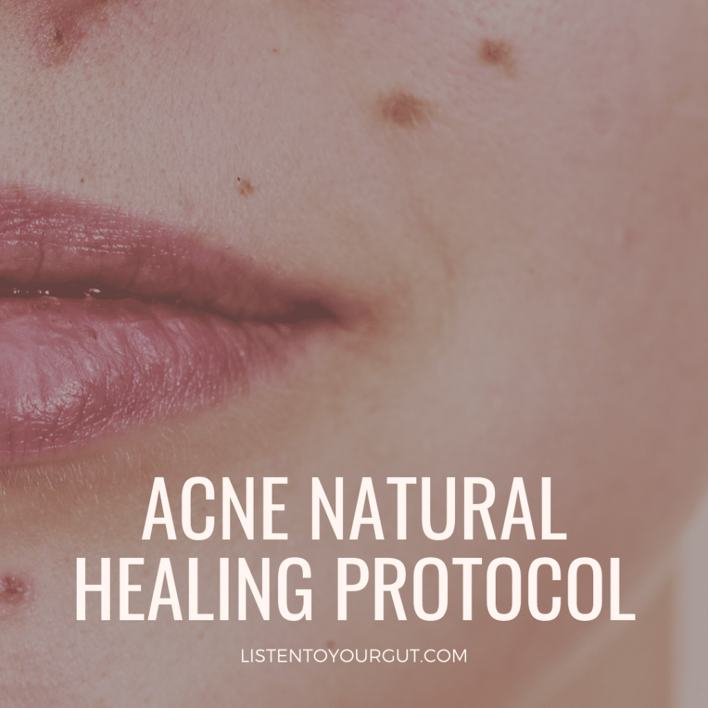 Natural Acne Healing Protocol